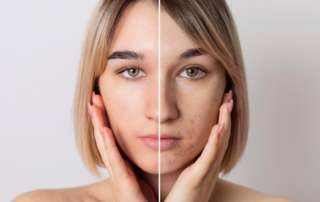 Ozempic Face Explained